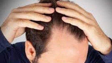 Saç Dökülmelerinde Aromaterapi Uygulamaları
